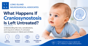 What Happens If Craniosynostosis Is Left Untreated?